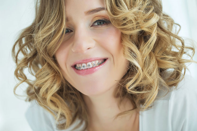 Kieferorthopädie für Erwachsene